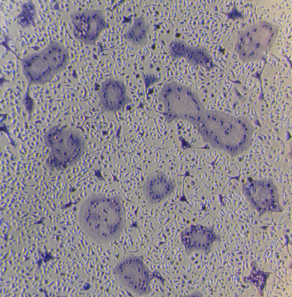 Mouse Bone Marrow-derived Macrophages (BMMs) Osteoclast Differentiation Cytokine Kit