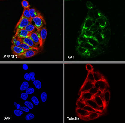 AAT Recombinant Rabbit mAb (S-943-37)
