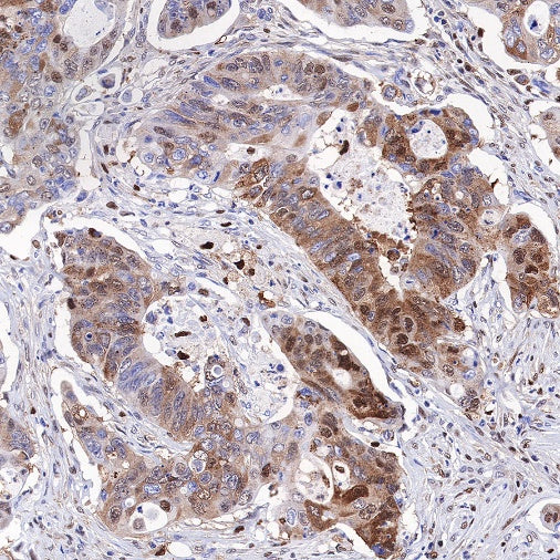 SQSTM1/p62 Recombinant Rabbit mAb (S-778-1)