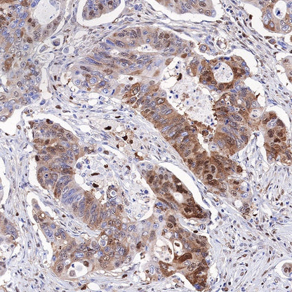 SQSTM1/p62 Recombinant Rabbit mAb (S-778-1)