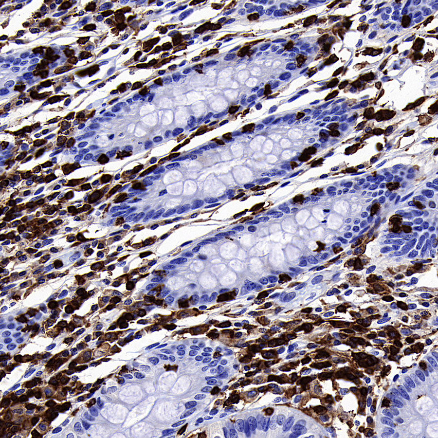 FOXO4 Recombinant Rabbit mAb (S-3527-19)