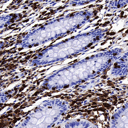 FOXO4 Recombinant Rabbit mAb (S-3527-19)