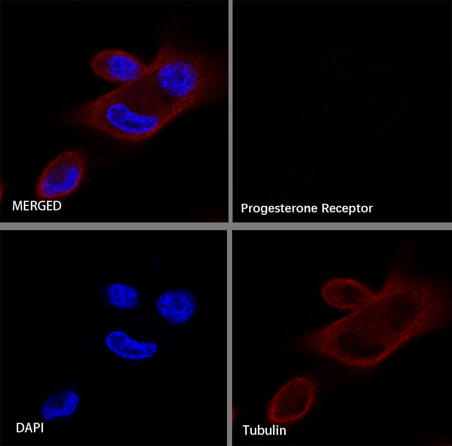 Progesterone Receptor Recombinant Rabbit mAb (SDT-R123)