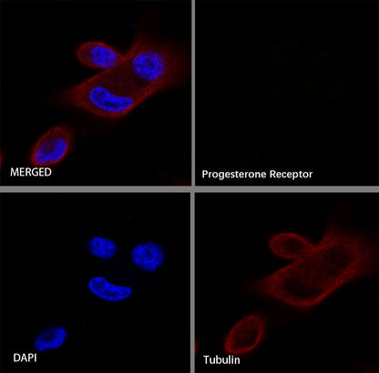 Progesterone Receptor Recombinant Rabbit mAb (SDT-R123)