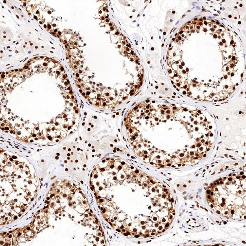PRMT1 Recombinant Rabbit mAb (S-884-10)