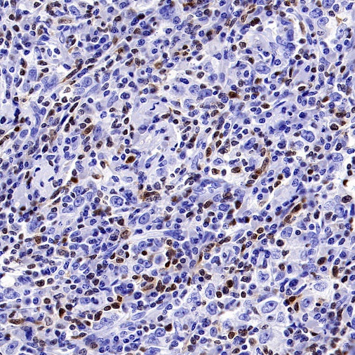 TOX Recombinant Rabbit mAb (S-2296-44)