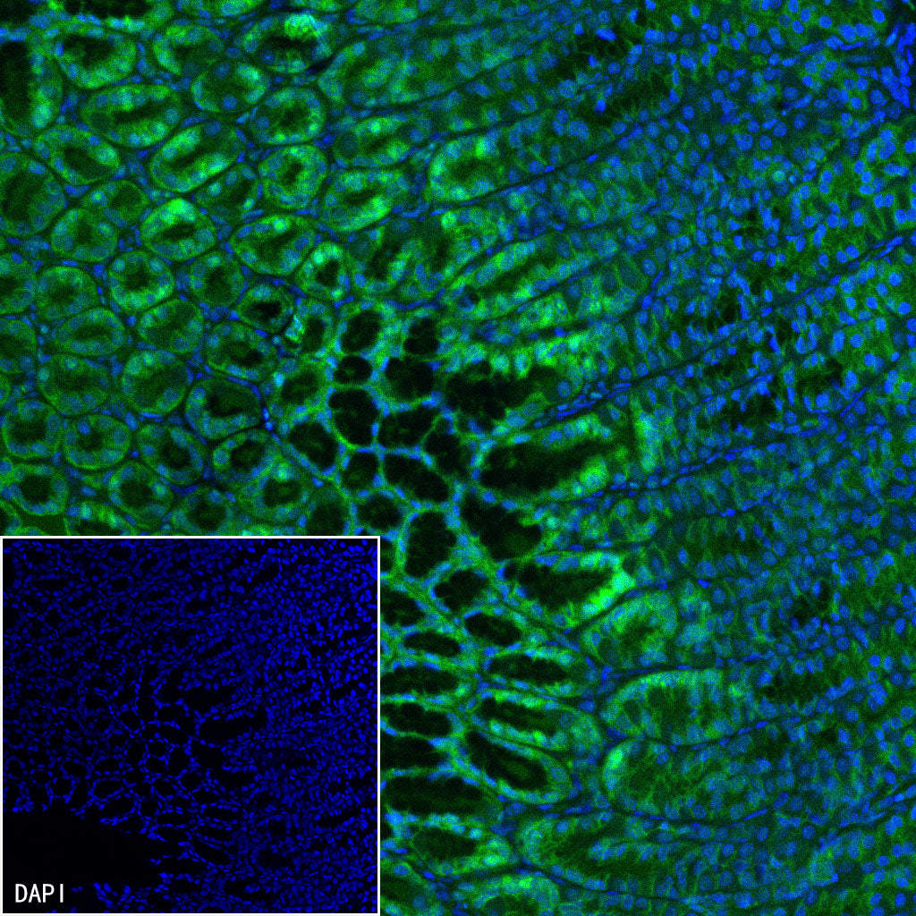 Claudin 18.2 Recombinant Rabbit mAb (FITC Conjugate) (SDT-102-24)