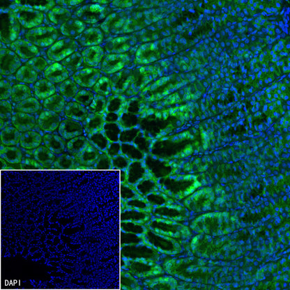 Claudin 18.2 Recombinant Rabbit mAb (FITC Conjugate) (SDT-102-24)