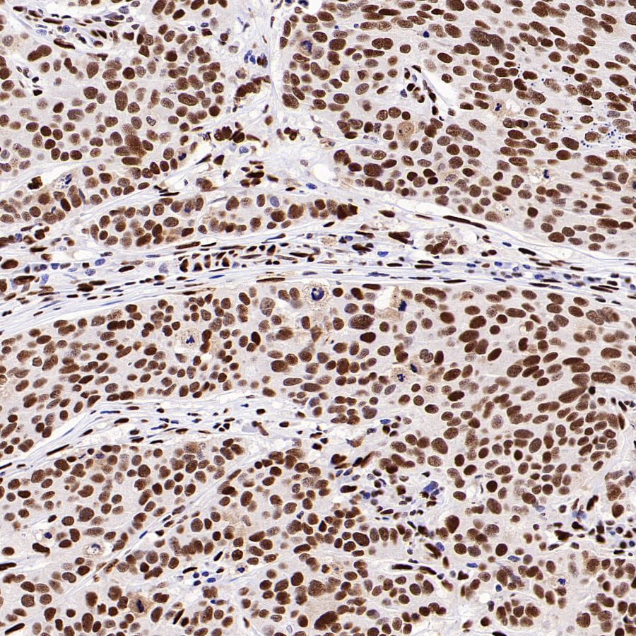 PML Recombinant Rabbit mAb (S-1908-60)