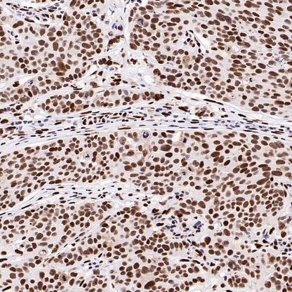 PML Recombinant Rabbit mAb (S-1908-60)