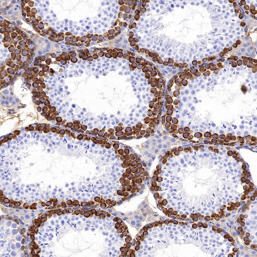 DAZL Recombinant Rabbit mAb (S-1552-6)
