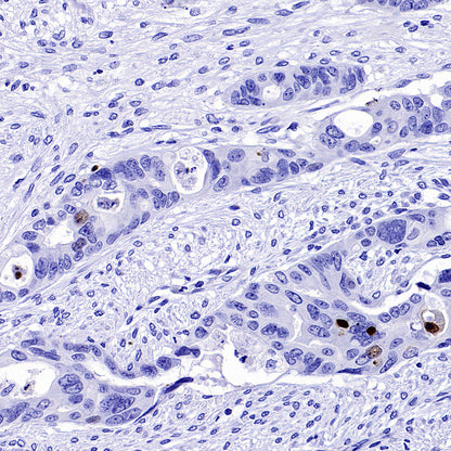 Phospho-DNA-PKcs (Ser2056) Recombinant Rabbit mAb (S-3813)