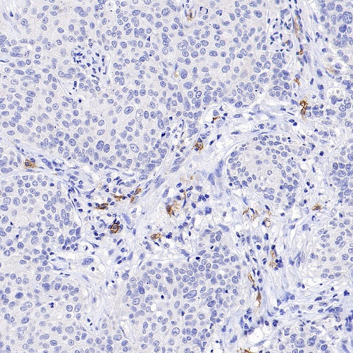 FCER1A/FcεRIα Recombinant Rabbit mAb (S-1697-174)