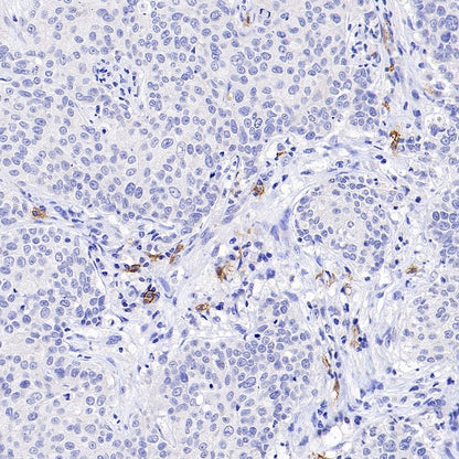 FCER1A/FcεRIα Recombinant Rabbit mAb (S-1697-174)
