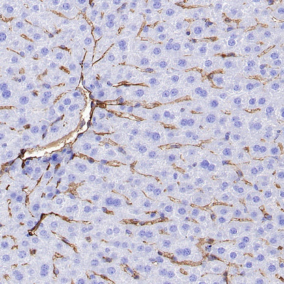 CD31 Recombinant Rabbit mAb (S-R568)