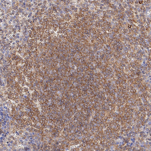 IKK gamma Recombinant Rabbit mAb (S-1359-118)