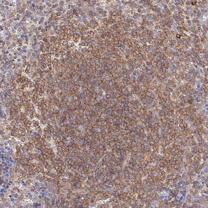 IKK gamma Recombinant Rabbit mAb (S-1359-118)