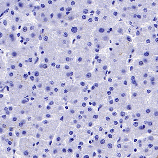 Vesicular Glutamate Transporter 1 (VGLUT1) Recombinant Rabbit mAb (S-1118-58)