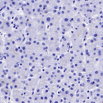 Vesicular Glutamate Transporter 1 (VGLUT1) Recombinant Rabbit mAb (S-1118-58)