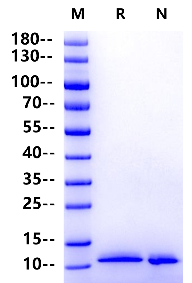NRG1 Beta 1 His Tag Protein, Human