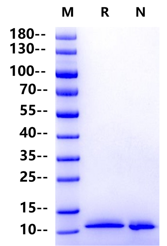 NRG1 Beta 1 His Tag Protein, Human