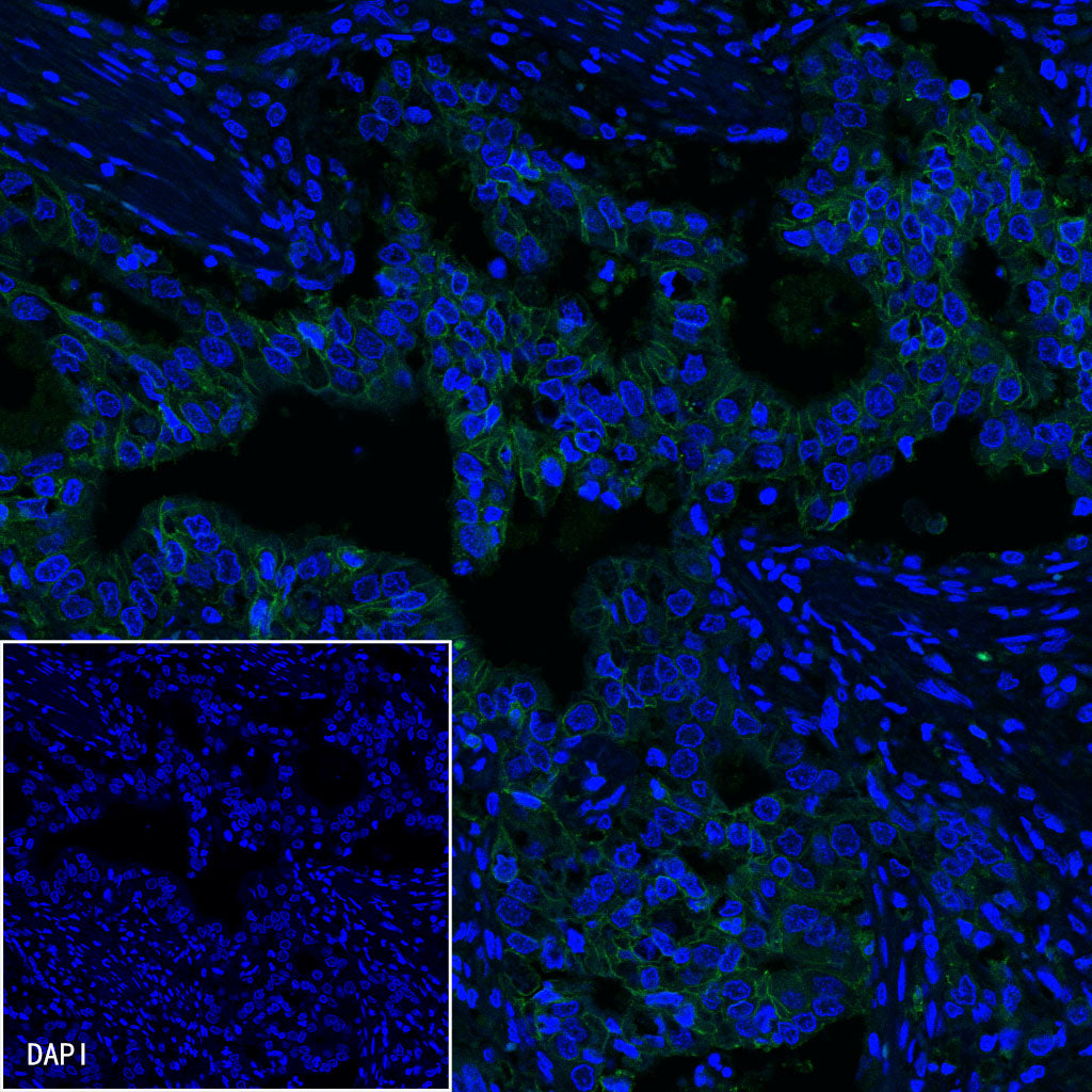 Claudin18.2 Recombinant Rabbit mAb,PBS Only (SDT-102-24)