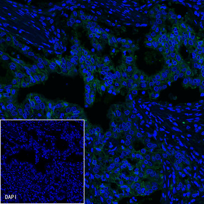 Claudin18.2 Recombinant Rabbit mAb,PBS Only (SDT-102-24)