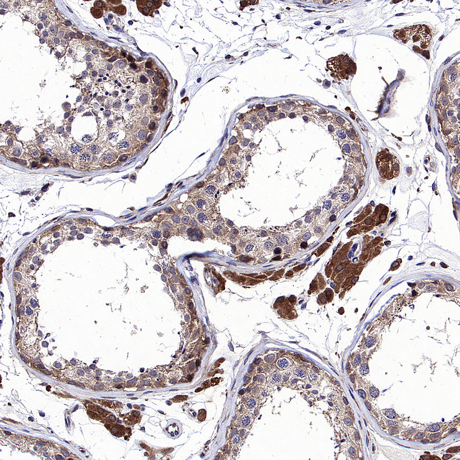APOL2 Recombinant Rabbit mAb (S-3627-115)