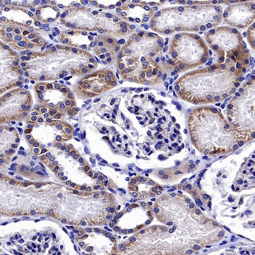 ATP7A Recombinant Rabbit mAb (S-2289-106)