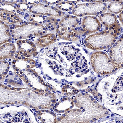 ATP7A Recombinant Rabbit mAb (S-2289-106)