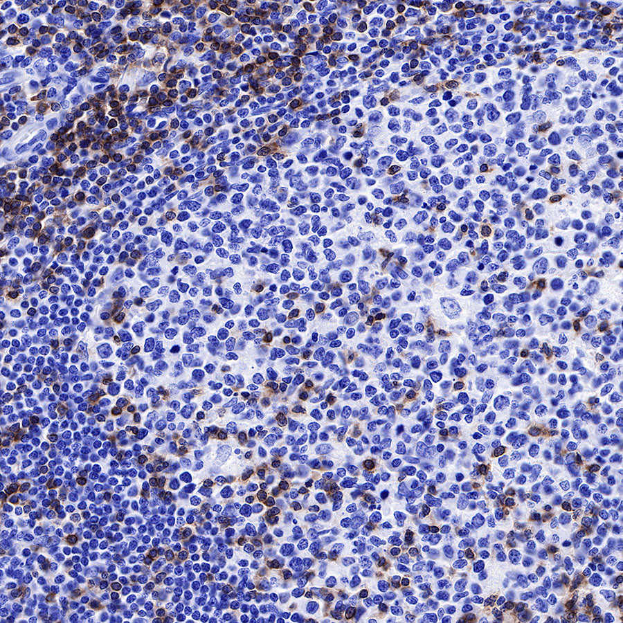 CD3 epsilon Recombinant Rabbit mAb (SDT-241-49)