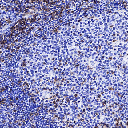 CD3 epsilon Recombinant Rabbit mAb (SDT-241-49)