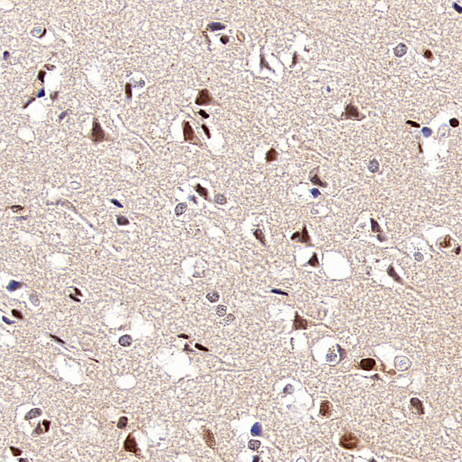 SF3B1 Rabbit Polyclonal Antibody