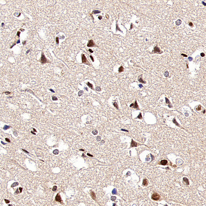 SF3B1 Rabbit Polyclonal Antibody