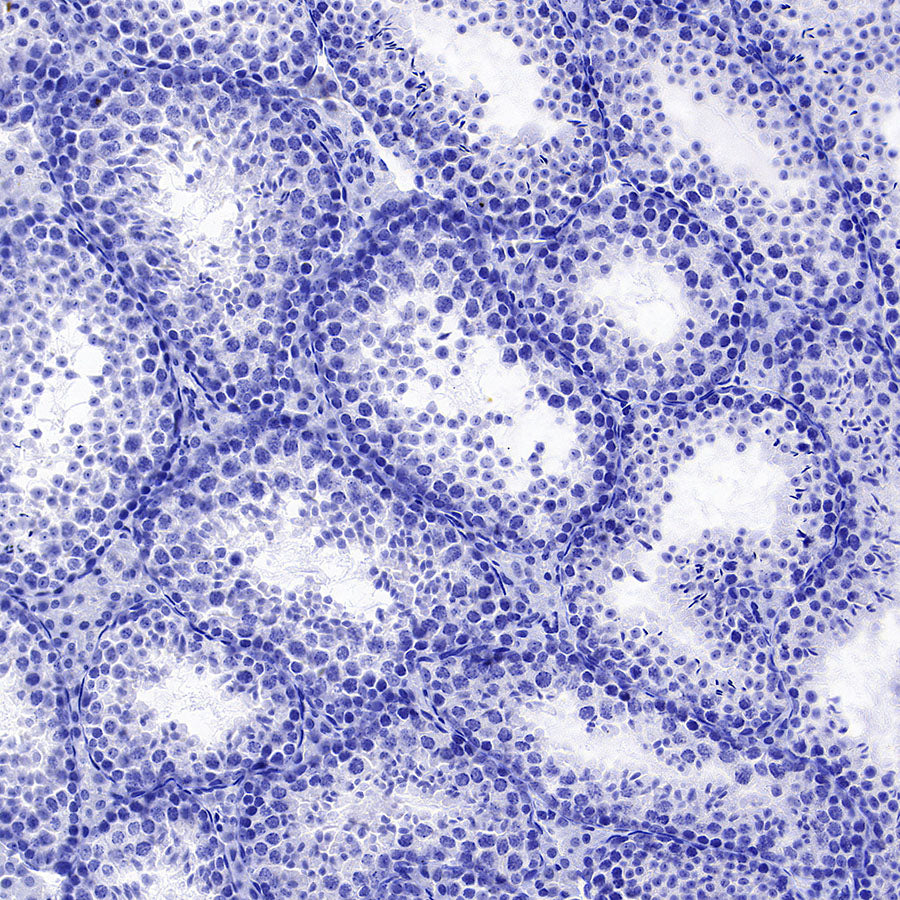PNPLA2 Recombinant Rabbit mAb (S-5409)