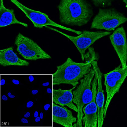 Beta I tubulin Recombinant Rabbit mAb (S-3108-63)