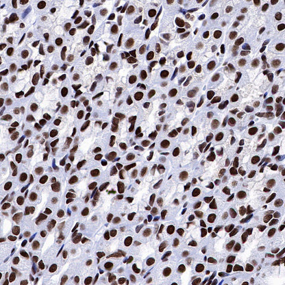 NuMA Recombinant Rabbit mAb (SDT-474-241)