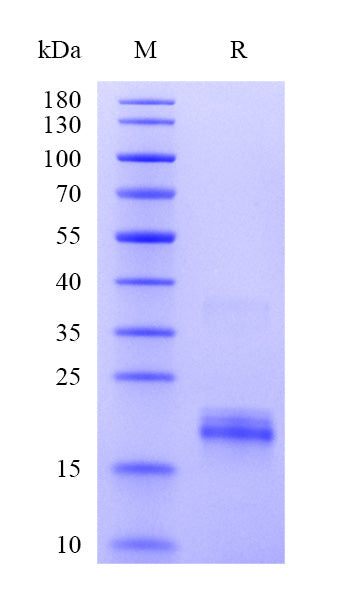 Human IL-10 Protein, His Tag