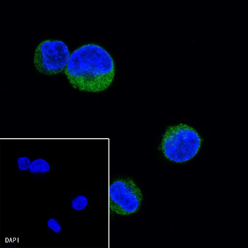 CD25/IL-2Rα Recombinant Rabbit mAb (S-R223)