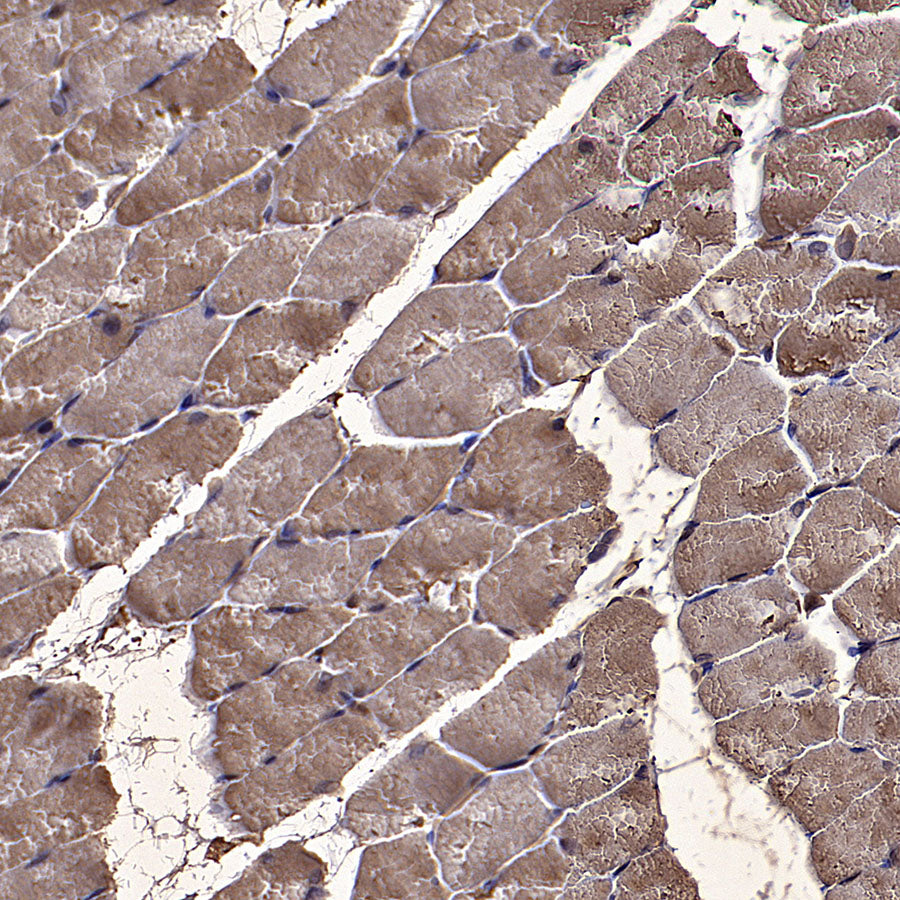 ALDOA Mouse mAb