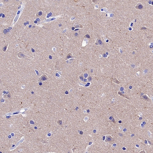 Choline Acetyltransferase/ChAT Recombinant Rabbit mAb (S-2561-17)