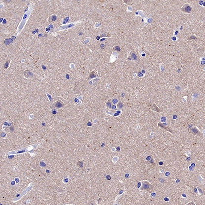 Choline Acetyltransferase/ChAT Recombinant Rabbit mAb (S-2561-17)