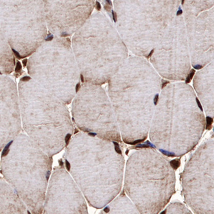 Parvalbumin Recombinant Rabbit mAb (S-1620-10)