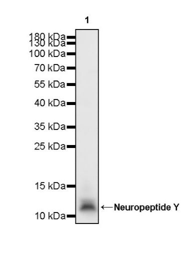 Neuropeptide Y Recombinant Rabbit mAb (S-1104-18)
