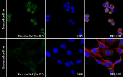 Phospho-YAP (Ser127) Recombinant Rabbit mAb (S-1364-28)