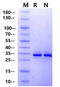 STUB1/CHIP Protein, Human