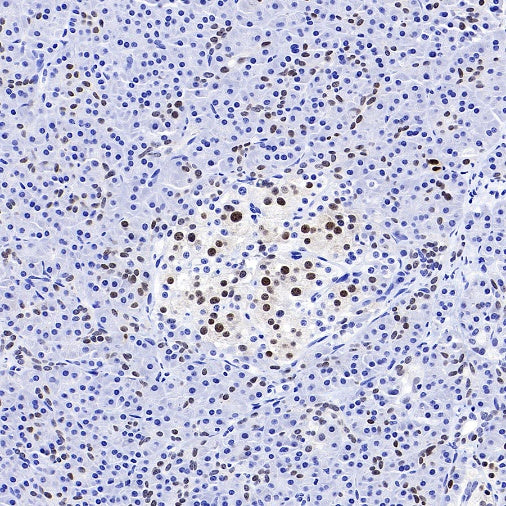 PDX1 Rabbit Polyclonal Antibody