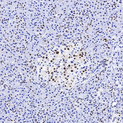 PDX1 Rabbit Polyclonal Antibody