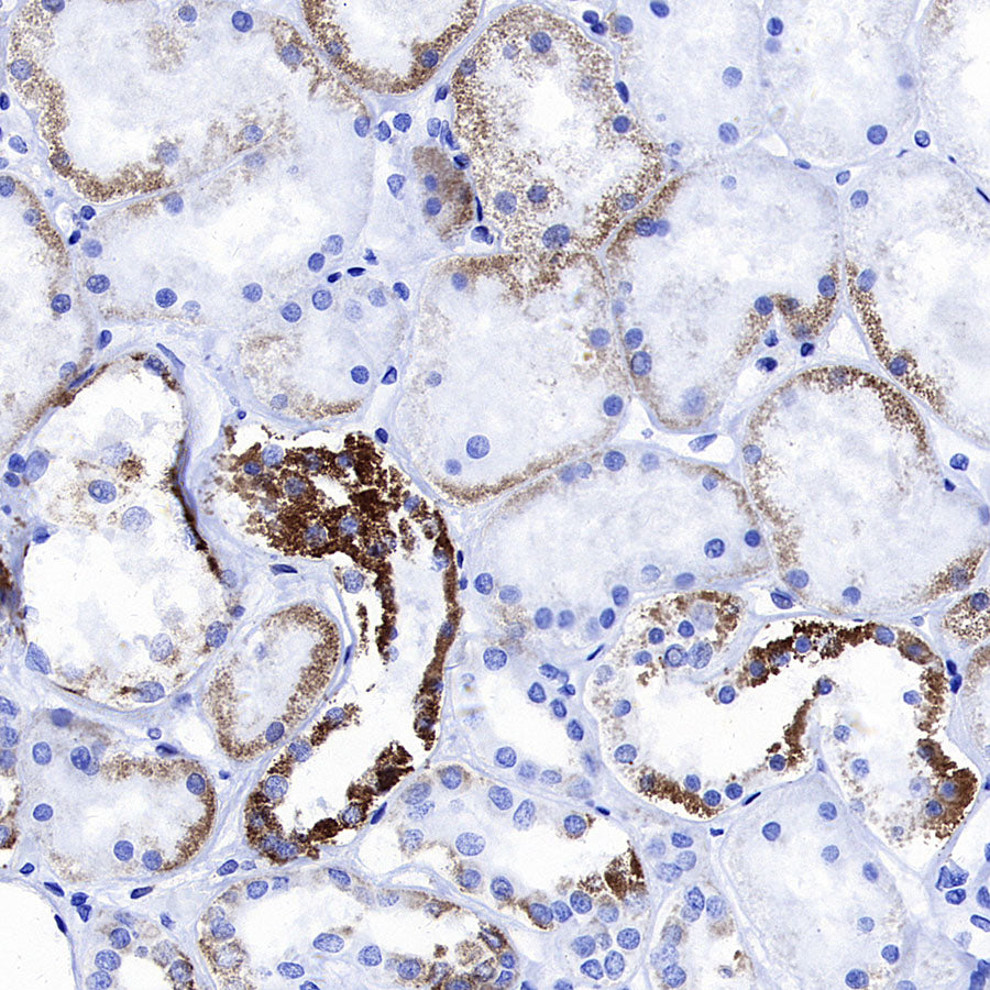 ATF-6 Recombinant Rabbit mAb (S-4366)