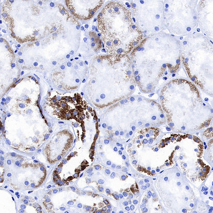 ATF-6 Recombinant Rabbit mAb (S-4366)